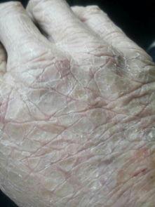 手长茧图片,手长茧的劳动者印记 第3张 手长茧图片,手长茧的劳动者印记 第3张