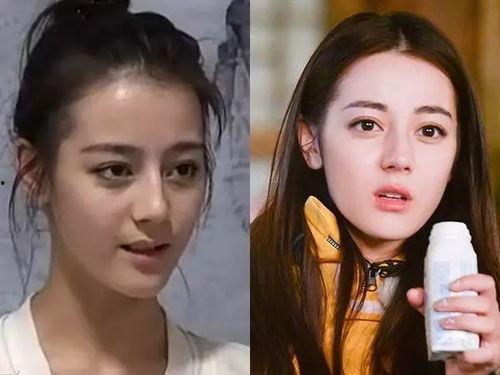 明星都是怎么变白的,揭秘明星如何轻松拥有白皙肌肤  第1张